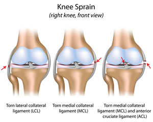 Knee injury grades