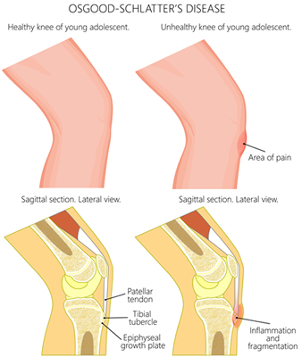 Knee anatomy